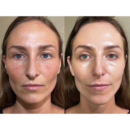 Tempurix Solution Mask Headache