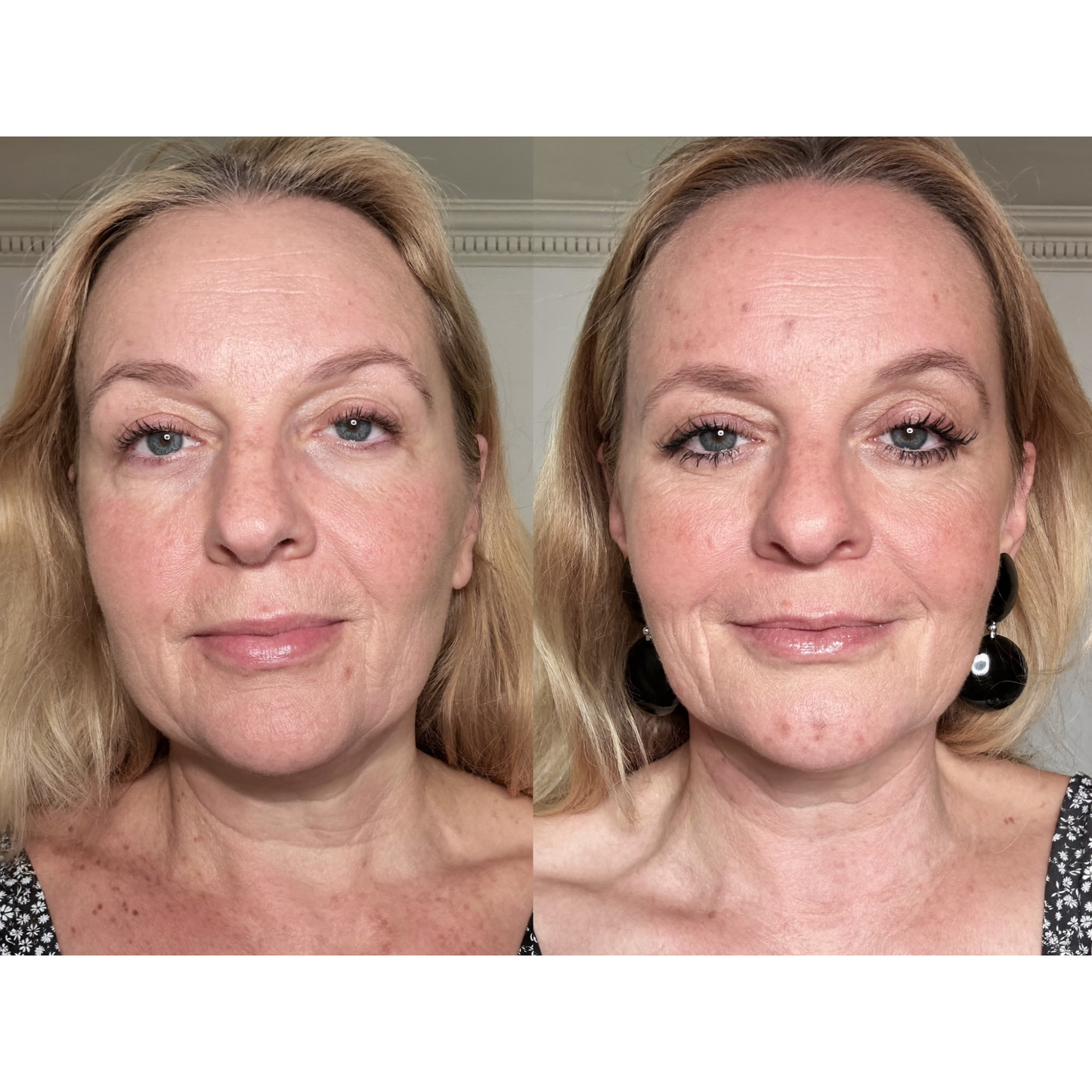 Tempurix Solution Mask Headache
